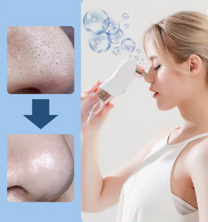 Extractor de Puntos Negros/ 🧴 ClearSkin Pro®